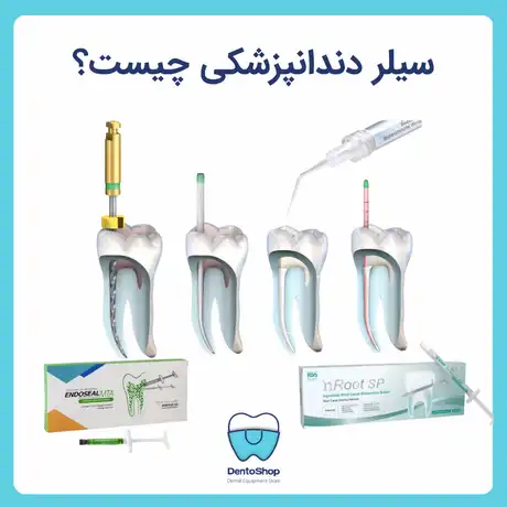 سیلر دندانپزشکی